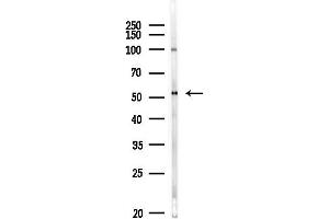 anti-Phosphodiesterase 1A (PDE1A) (Internal Region) antibody