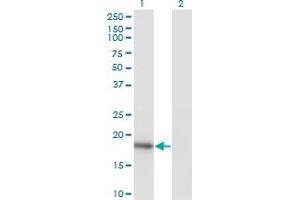 Western Blot analysis of KISS1 expression in transfected 293T cell line by KISS1 monoclonal antibody (M05), clone 1F7. (KISS1 Antikörper  (AA 46-145))