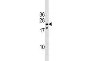Western Blotting (WB) image for anti-NK3 Homeobox 1 (NKX3-1) (AA 3-1) antibody (ABIN3032012)