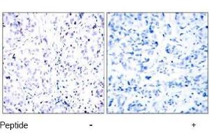 Image no. 1 for anti-Retinoblastoma 1 (RB1) (Ser807) antibody (ABIN197282) (Retinoblastoma 1 Antikörper  (Ser807))