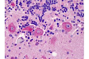 Anti-C5L2 antibody IHC of human brain, cerebellum. (GPR77 Antikörper  (AA 1-50))
