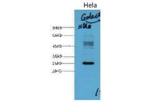 Western Blot (WB) analysis of HeLa, diluted at 1:3000. (Galectin 3 Antikörper)