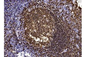 Immunohistochemistry (IHC) image for anti-Membrane-Spanning 4-Domains, Subfamily A, Member 1 (MS4A1) (AA 266-294), (C-Term) antibody (ABIN1536600)
