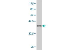 Western Blot detection against Immunogen (37. (IL18RAP Antikörper  (AA 20-129))