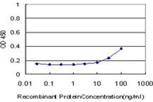 Detection limit for recombinant GST tagged GTF3A is approximately 10ng/ml as a capture antibody. (GTF3A Antikörper  (AA 185-274))