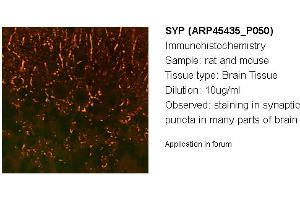 Image no. 2 for anti-Synaptophysin (SYP) (N-Term) antibody (ABIN502628) (Synaptophysin Antikörper  (N-Term))