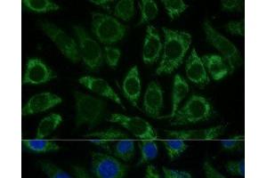 Immunofluorescence analysis of L929 cells using NDUFS8 Polyclonal Antibody at dilution of 1:100 (40x lens). (NDUFS8 Antikörper)