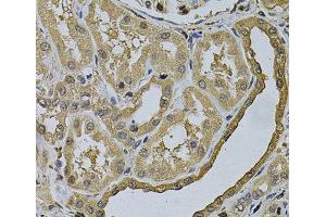 Immunohistochemistry of paraffin-embedded Human kidney using LCP1 Polyclonal Antibody at dilution of 1:100 (40x lens). (LCP1 Antikörper)
