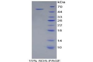 SDS-PAGE analysis of Pig Adiponectin Protein. (ADIPOQ Protein)