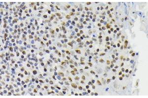 Immunohistochemistry of paraffin-embedded Human tonsil using Phospho-CREB1(S133) Polyclonal Antibody at dilution of 1:200 (40x lens). (CREB1 Antikörper  (pSer133))