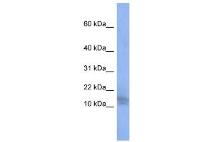 WB Suggested Anti-BRWD1 Antibody Titration:  0. (BRWD1 Antikörper  (N-Term))