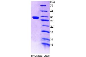 SDS-PAGE (SDS) image for Protein tyrosine Phosphatase, Non-Receptor Type 14 (PTPN14) (AA 1-188) protein (His tag) (ABIN6239272)