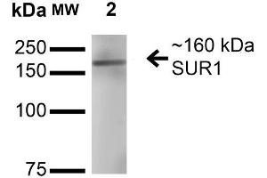 Western Blot analysis of Rat Brain Membrane showing detection of ~160 kDa SUR1 protein using Mouse Anti-SUR1 Monoclonal Antibody, Clone S289-16 . (ABCC8 Antikörper  (AA 1548-1582) (Atto 390))