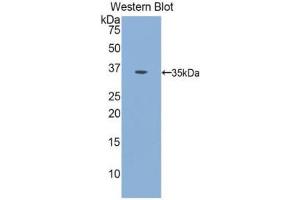 Western Blotting (WB) image for anti-Insulin Receptor (INSR) (AA 1024-1298) antibody (ABIN1078206)