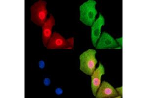 ABIN7095242 and ABIN7099299 staining Hela cells by IF/ICC.