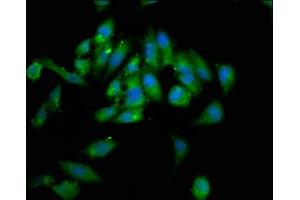 Immunofluorescence staining of Hela cells with ABIN7155501 at 1:133, counter-stained with DAPI. (WHSC1 Antikörper  (AA 1-44))