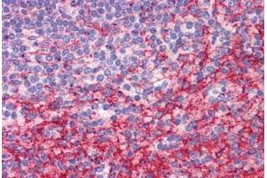 Human Spleen: Formalin-Fixed, Paraffin-Embedded (FFPE) (ATG9B Antikörper  (C-Term))