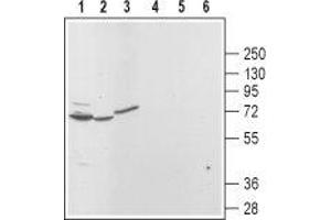 Western blot analysis of rat brain (lanes 1 and 4), kidney (lanes 2 and 5) and pancreas (lanes 3 and 6): - 1,2,3. (Mucolipin 3 Antikörper  (Cytoplasmic Domain, Intracellular))