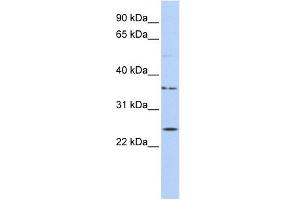 IQCF1 antibody used at 1 ug/ml to detect target protein. (IQCF1 Antikörper  (Middle Region))
