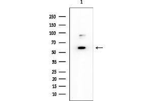 Western blot analysis of lysates from EC304 cells, using KCNS2 Mouse Monoclonal Antibody at 1/1000 dilution.