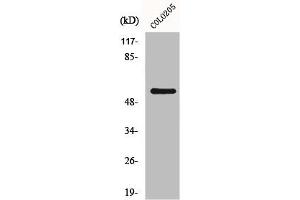 Western Blot analysis of HeLa cells using GRK 7 Polyclonal Antibody (GRK7 Antikörper  (Internal Region))