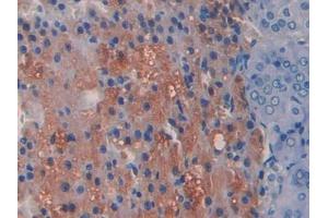 DAB staining on IHC-P; Samples: Rat Adrenal gland Tissue (ADAMTS1 Antikörper  (AA 854-967))