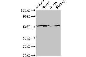 Western Blot Positive WB detected in: Rat kidney tissue, Mouse heart tissue, Mouse brain tissue, Mouse kidney tissue All lanes: NDUFS2 antibody at 6.
