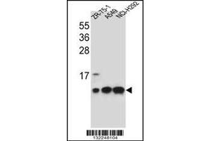 Western blot analysis in ZR-75-1,A549,NCI-H292 cell line lysates (35ug/lane). (COX6B1 Antikörper  (C-Term))