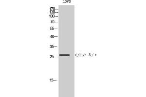 Western Blot analysis of LOVO cells using C/EBP δ/ε Polyclonal Antibody diluted at 1:500. (C/EBP delta/epsilon (AA 140-220) Antikörper)