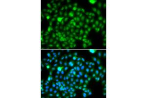 Immunofluorescence analysis of A549 cells using N6AMT1 antibody (ABIN5974334). (N6AMT1 Antikörper)