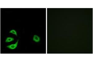 Immunofluorescence analysis of A549 cells, using ACOT8 Antibody. (ACOT8 Antikörper  (AA 131-180))