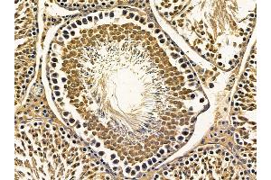 ABIN7095646 and ABIN7099708 at 1/100 staining rat testis tissue by IHC-P. (C16orf80 Antikörper)