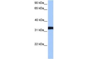 Western Blotting (WB) image for anti-Lactate Dehydrogenase C (LDHC) antibody (ABIN2463575)