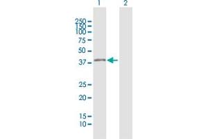 Western Blotting (WB) image for anti-Bartter Syndrome, Infantile, with Sensorineural Deafness (Barttin) (BSND) (AA 1-320) antibody (ABIN521644)