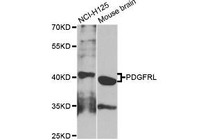 Western blot analysis of extracts of NCI-H125 and mouse brain cell lines, using PDGFRL antibody.