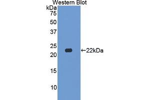 Western blot analysis of the recombinant protein. (CSN2 Antikörper  (AA 41-198))