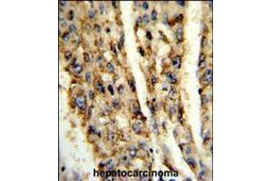 Immunohistochemistry (IHC) image for anti-Deiodinase, Iodothyronine, Type III (DIO3) (AA 250-278), (C-Term) antibody (ABIN5532317)