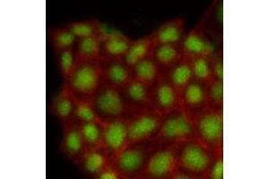 Immunofluorescenitrocellulosee of human MCF7 cells stained with Phalloidin-TRITC (Red) for Actin staining and monoclonal anti-human MAPK1 antibody (1:500) with Alexa 488 (Green). (ERK2 Antikörper)