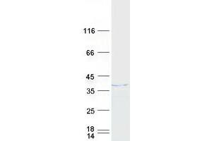 Western Blotting (WB) image for Heterogeneous Nuclear Ribonucleoprotein H3 (2H9) (HNRNPH3) protein (Myc-DYKDDDDK Tag) (ABIN2722923)