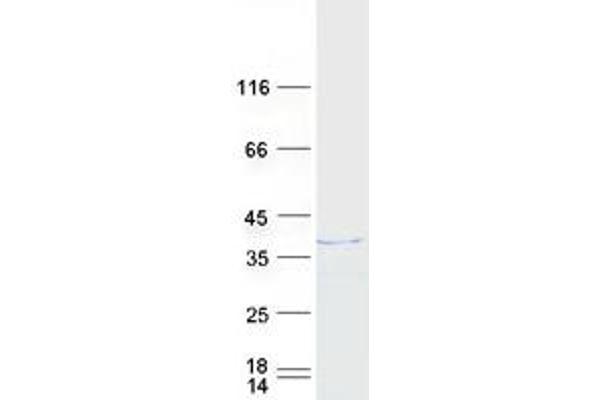 HNRNPH3 Protein (Myc-DYKDDDDK Tag)