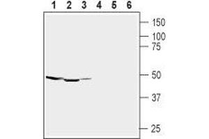 Western blot analysis of rat brain (lanes 1 and 4), mouse brain (lanes 2 and 5) membranes and human brain neuroblastoma (SH-SY5Y) (lanes 3 and 6) cell lysate:1-3. (gamma-aminobutyric Acid (GABA) A Receptor, alpha 1 (GABRA1) Peptid)