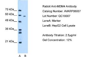 WB Suggested Anti-MDM4 AntibodyTitration: 2. (MDM4-binding Protein Antikörper  (N-Term))