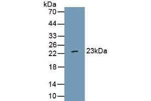 Detection of Recombinant vWA5B2, Human using Polyclonal Antibody to Von Willebrand Factor A Domain Containing Protein 5B2 (vWA5B2) (VWA5B2 Antikörper  (AA 354-527))
