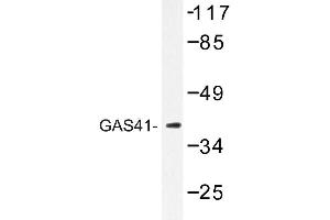 Image no. 1 for anti-YEATS Domain Containing 4 antibody (ABIN272151) (GAS41 Antikörper)
