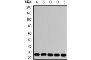 Western blot analysis of RAB17 expression in Jurkat (A), A431 (B), mouse brain (C), mouse kidney (D), rat liver (E) whole cell lysates. (RAB17 Antikörper)