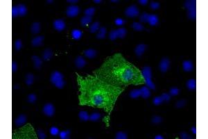 Anti-KIAA1609 mouse monoclonal antibody (ABIN2453206) immunofluorescent staining of COS7 cells transiently transfected by pCMV6-ENTRY KIAA1609 (RC209287). (KIAA1609 Antikörper)
