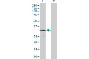 Western Blot analysis of SDHB expression in transfected 293T cell line by SDHB MaxPab polyclonal antibody.