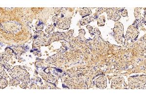 Immunohistochemistry (IHC) image for anti-Procollagen III N-Terminal Propeptide (PIIINP) antibody (ABIN7427888)