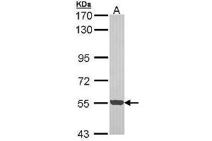 WB Image Sample (30 ug of whole cell lysate) A: Hep G2 , 7. (CDK18 Antikörper)