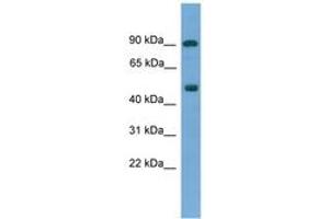 Image no. 1 for anti-Mediator Complex Subunit 25 (MED25) (AA 33-82) antibody (ABIN6745504) (MED25 Antikörper  (AA 33-82))